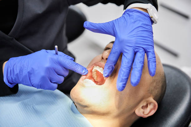 Best Emergency Tooth Extraction in Warren Park, IN